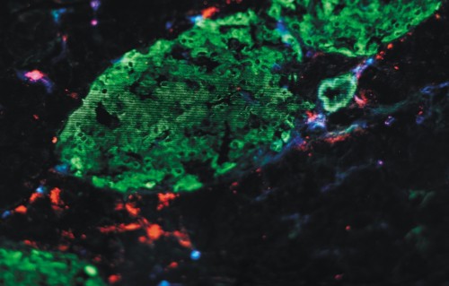 Getting under the hood of immunity