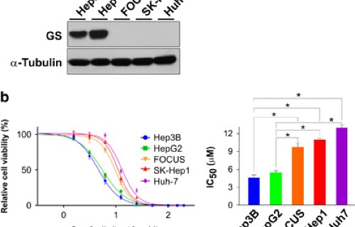 Glutamine Synthetase Mediates Sorafenib Sensitivity In B Catenin Active Hepatocellular Carcinoma Cells Experimental Molecular Medicine