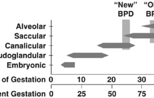Antenatal Inflammation And Lung Injury Prenatal Origin Of Neonatal Disease Journal Of Perinatology