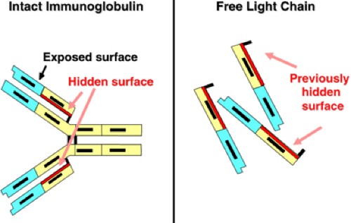 International Myeloma Working Group guidelines for serum-free light chain  analysis in multiple myeloma and related disorders | Leukemia