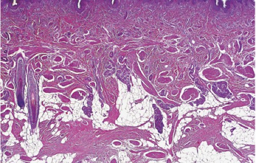 suplimente de detoxifiere hepatică și renală