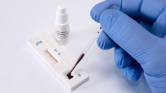 Test, troponin, on myocardial infarction