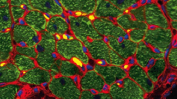 Fluorescence image of a drug in tissue