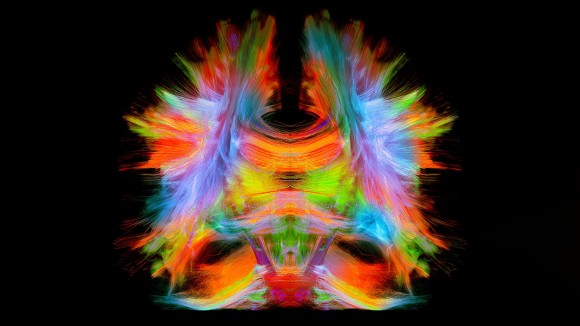 Full brain tractography with artistic color.