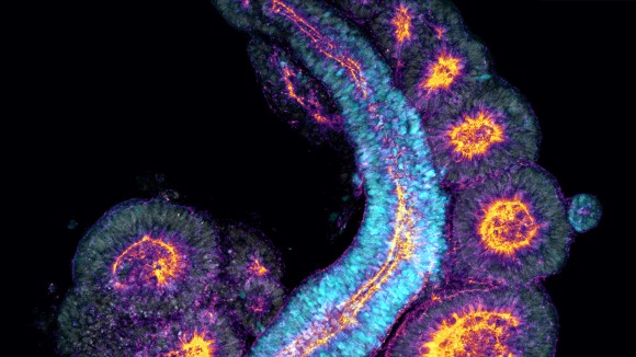 Embryo エンブリオ Stem cell-based embryo models