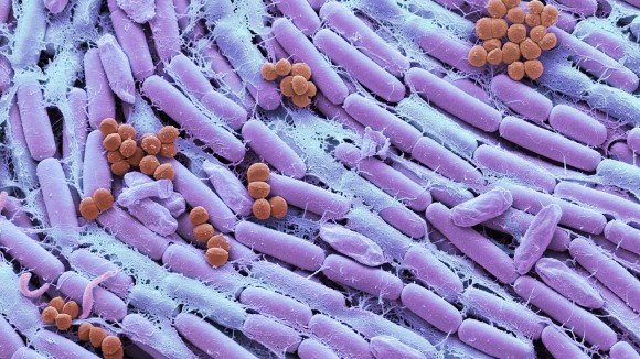 Coloured scanning electron micrograph (SEM) of orange spherical and purple rod-shaped bacteria