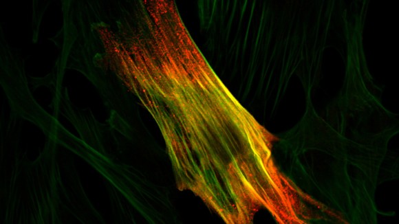 High resolution image of a human muscle cell, fluorescently stained for cell markers and showcasing the detail afforded by high resolution microscopy