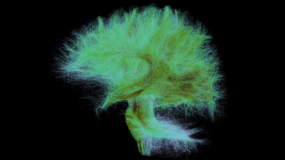 Full human brain fibers. Side view with fibers coming from the spinal cord and cerebellum. The darker the color, the denser the fibers - stock photo