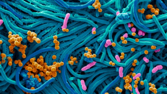 microbiology term paper topics