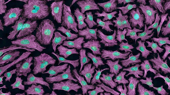 Collection of cells with magenta coloured cytoskeletal microtubules surrounding cyan coloured DNA against a dark background