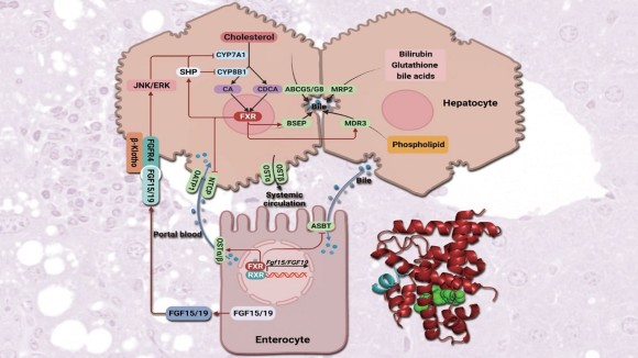 Nonalcoholic Steatohepatitis