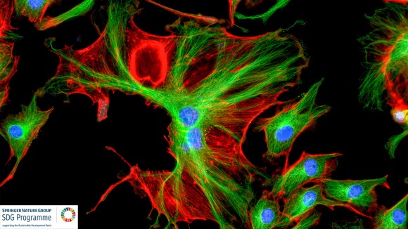 Bovine pulmonary artery endothelial cells stained red, green, and blue, with a black background