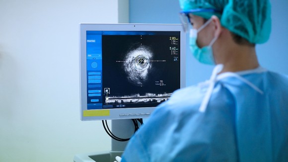 Doctor using Intravascular ultrasound imaging (IVUS) machine at cardiac catheterization laboratory room.