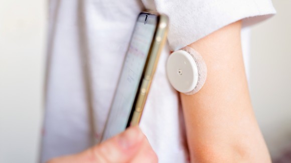 A continuous glucose monitoring system 