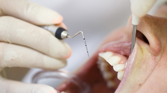 Periodontal work on a patient