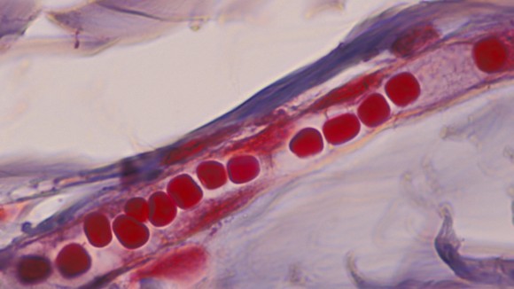 Red blood cells in capillary in human scalp, in single file. Shows epithelium. 400x at 35mm - stock photo