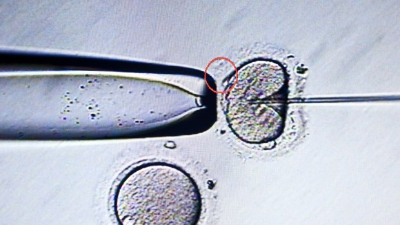 Computer screen image of sperm being injected into ovum, during invitro fertilization.