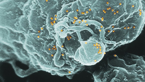 SEM of human immunodeficiency virus (HIV) - stock photo