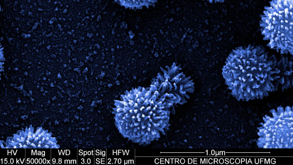 Microscopic image of giant virus
