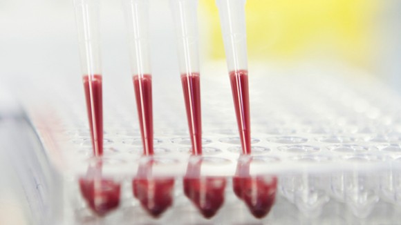 Pipettes filled with red liquid being deposited into plastic tray