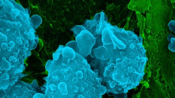 Colour-rendered Scanning Electron Micrograph of T. gondii Tachyzoites Egressing from Human Host Cells.