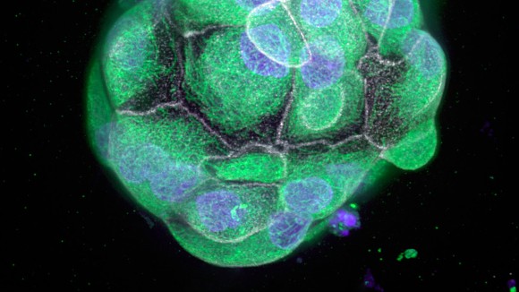 Micrograph of a colon cancer organoid culture.