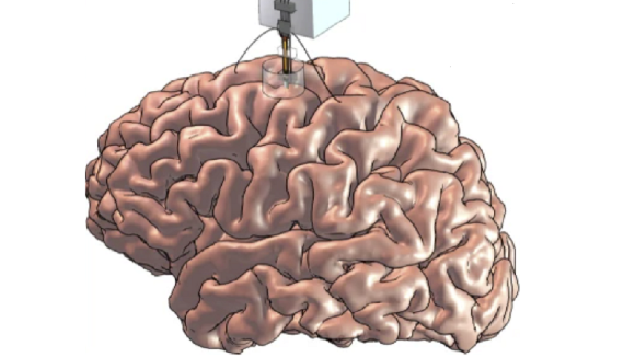 A Neuropixels probe inserted in the human brain