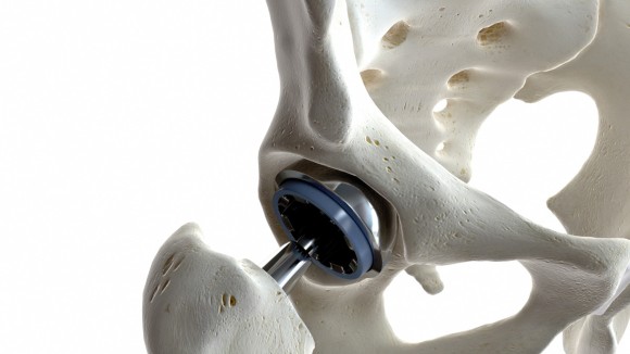Next-generation medical implants and clinical translation