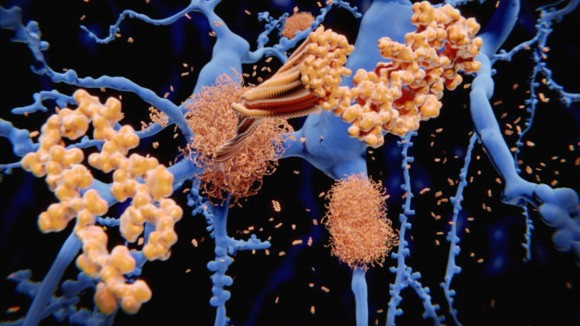 Alzheimer's disease: the amyloid-beta peptide
