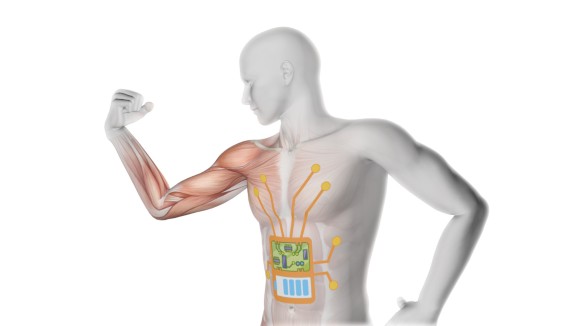 3D render of a male medical figure flexing arm with partial muscle map