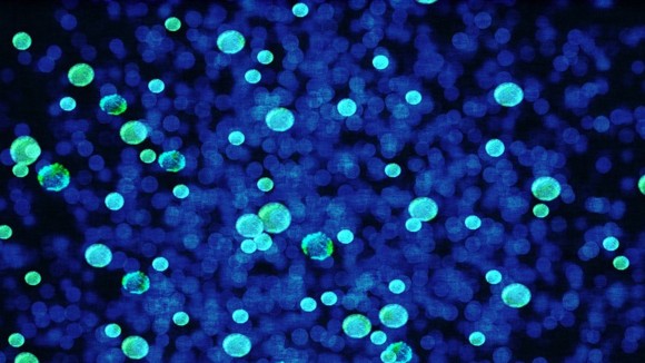 fluorescent cells under a microscope