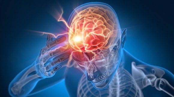 Man with a headache - Brain Stroke