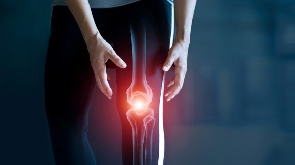 Woman suffering from pain in knee, Injury from workout and osteoarthritis, Tendon problems and Joint inflammation on dark background. 