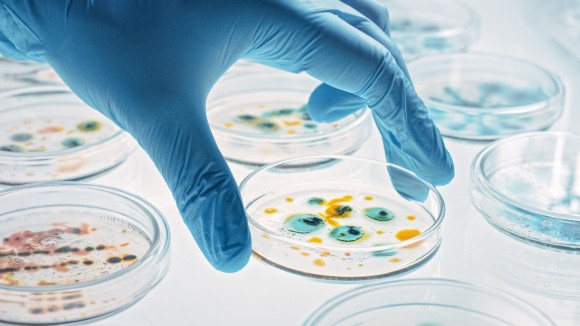A hand covered by a medical glove reaches for a petri dish filled with bacteria 