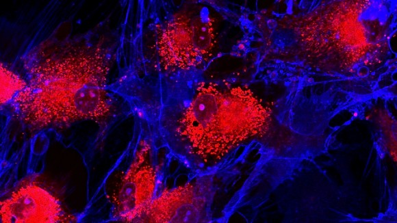 Real fluorescence microscopic view of Mesenchymal stem cells in red and blue fluorescence