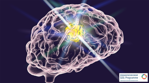 Graphical representation of a brain with a bright spot in the center signifying the presence of cancer cells