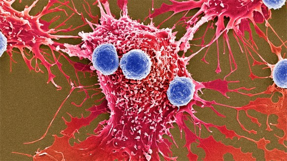 T lymphocytes and cancer cells