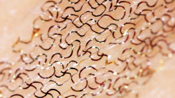 flexible electronics