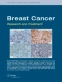 breast cancer research and treatment impact factor 2023