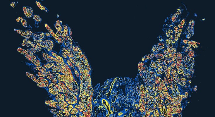 Nature Cancer September issue cover