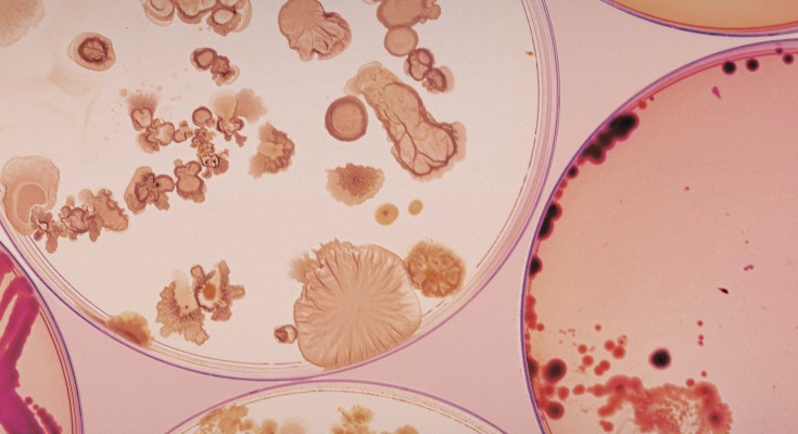 Bacterial colonies on agar plates against pink background