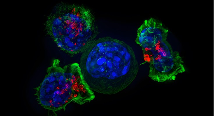 A cluster of T cells enveloping a cancer cell