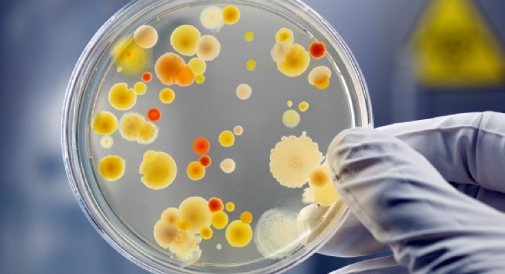 Petri dish with microbial cultures 