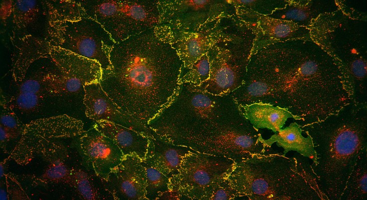 An image of human iPSC-derived cardiomyocytes