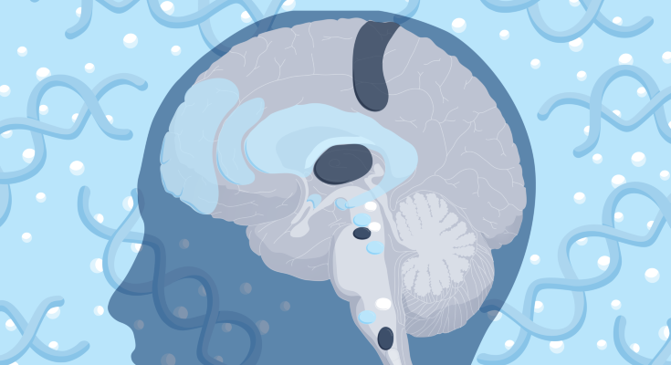 A schematic of medication overuse headache