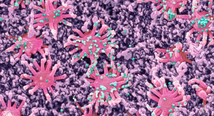 概念电子显微照片显示附着在鼻子嗅觉细胞上的小病毒颗粒