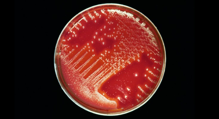 细菌菌落在培养皿中的血琼脂上生长时形成白色的峰和点