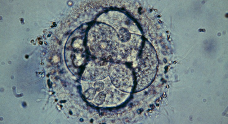 Light micrograph of a human embryo composed of four cells