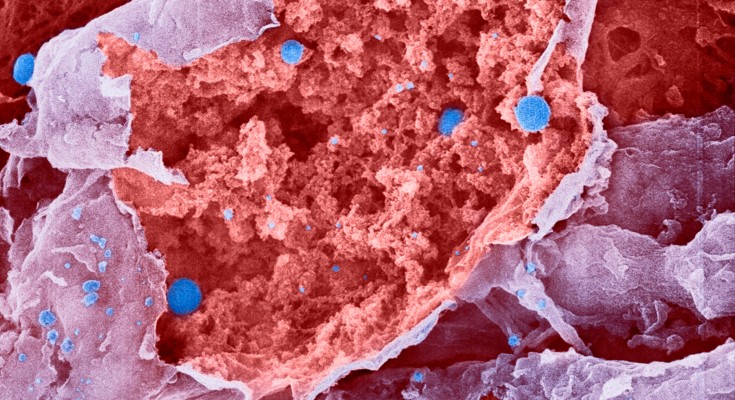 Coloured scanning electron micrograph of influenza viruses budding from a burst epithelial cell