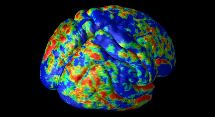 A 3D model of the brain with different areas coloured in blue, yellow, red and green